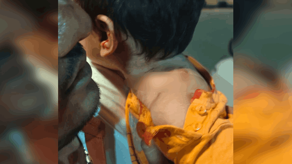 Dogs attack an innocent child playing in Jagdalpur