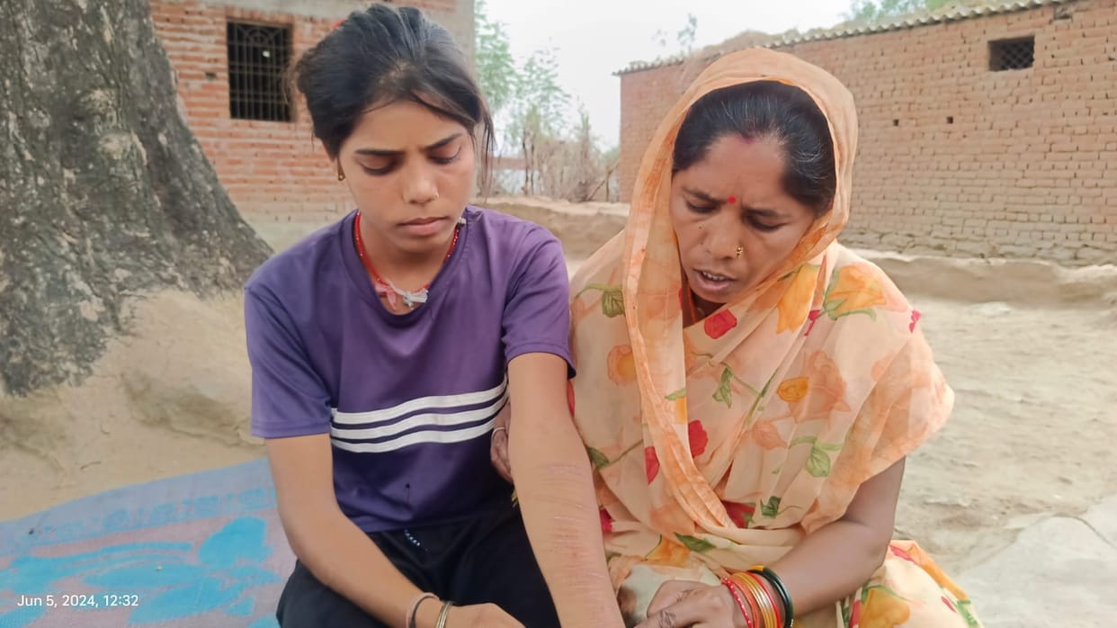 Damoh: Deep wounds in the hands and legs of the girl, doctor says there is some mental illness