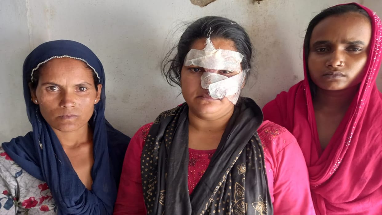 Bihar Crime: Bloody clash broke out in Gopalganj over children fighting, 4 people including 3 women injured