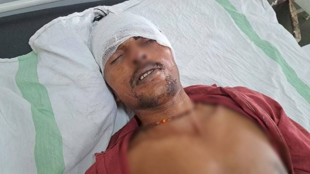 Chhatarpur Enemies attacked man with an axe while he was going for his daily activities