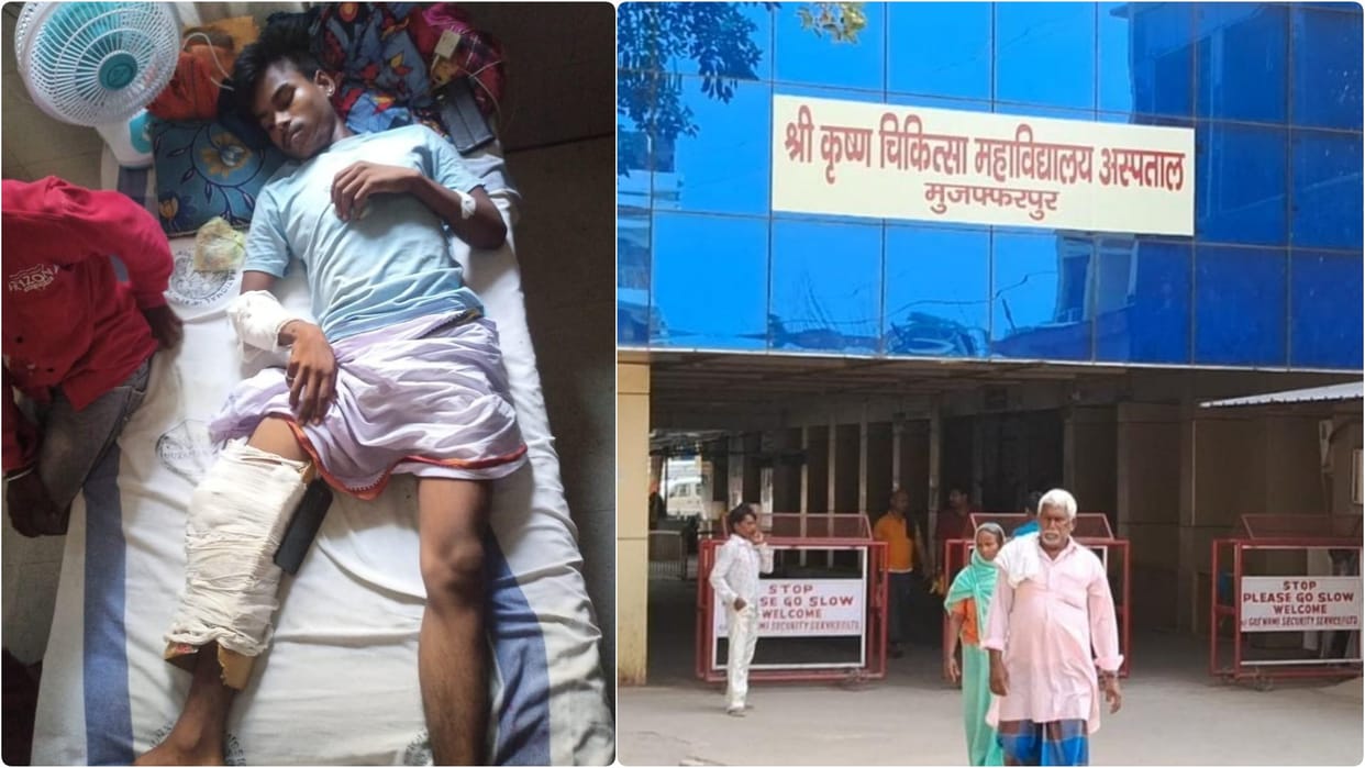 Muzaffarpur: Cardboard tied instead of plaster on leg of a patient injured in road accident, SKMCH  News