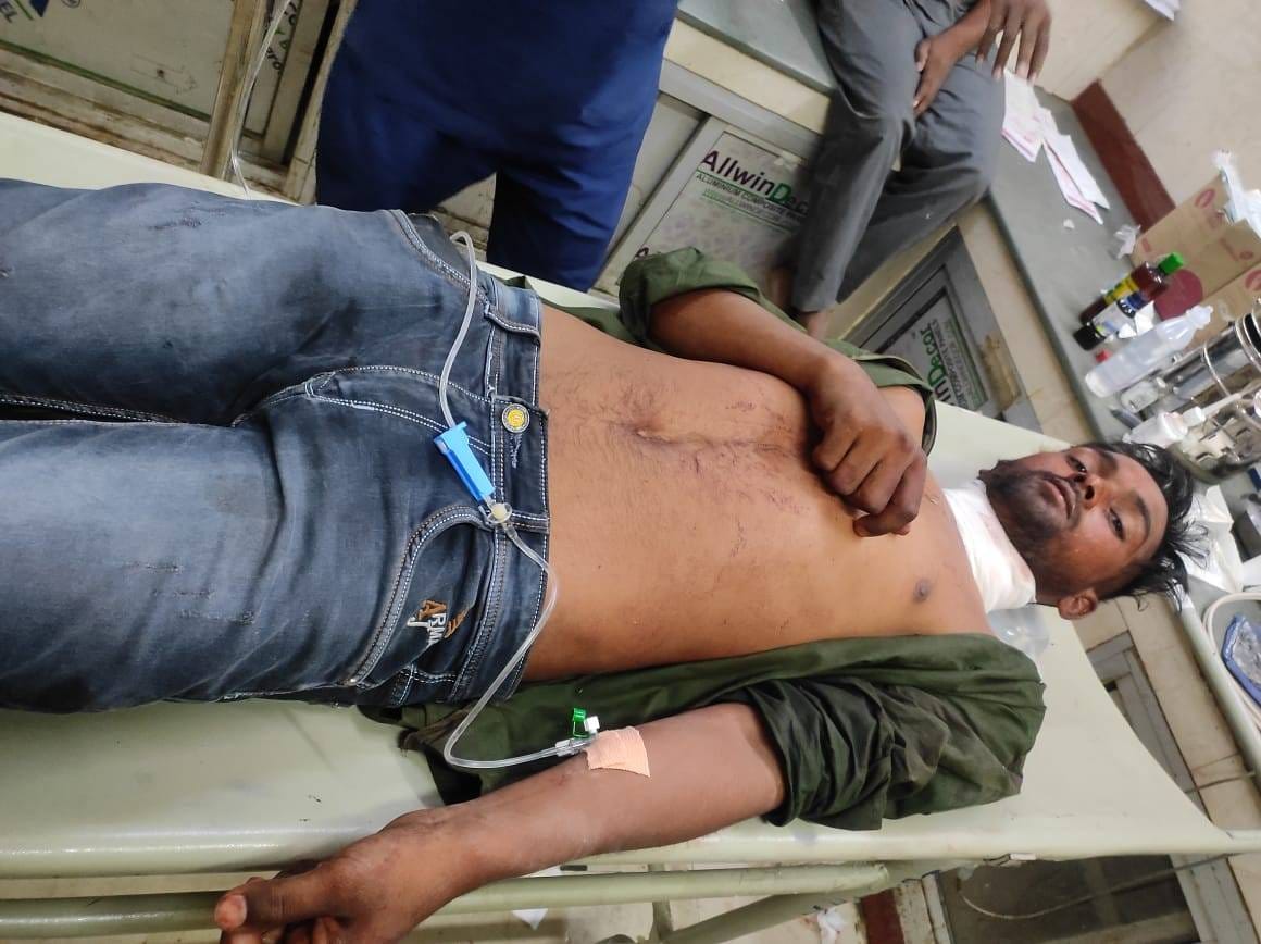Lucknow: After a dispute in the hotel at midnight, the girlfriend tied the hands and feet of the lover and att