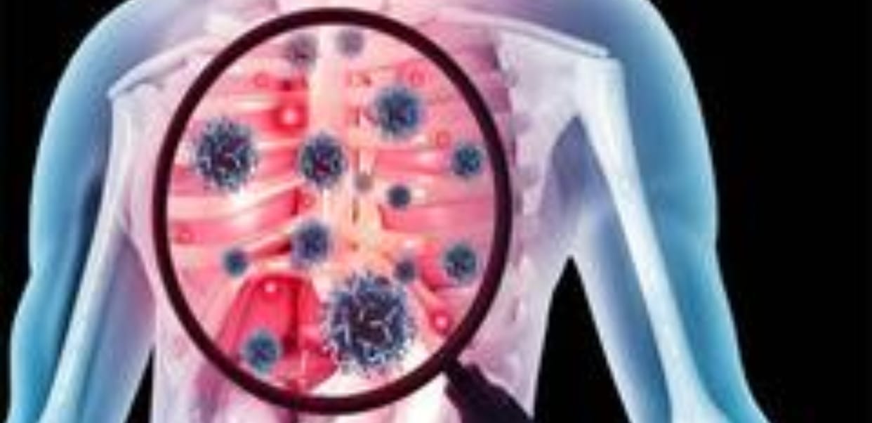 Haryana 47 percent TB cases found to be asymptomatic