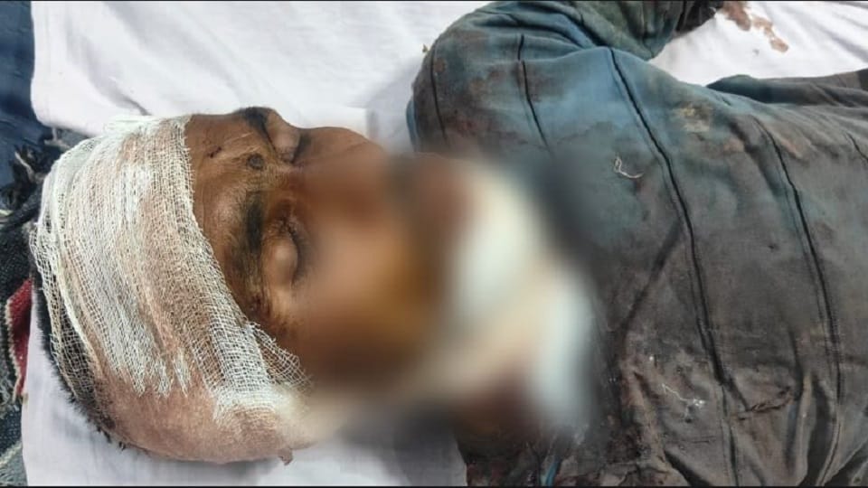 group of dogs attacked a young man cut off his ears and tore them from head to toe In Mathura