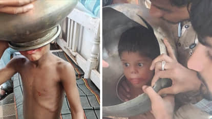 Vidisha: Five year old Sajid's head was stuck in a steel grate for an hour, it was removed with a cutter.
