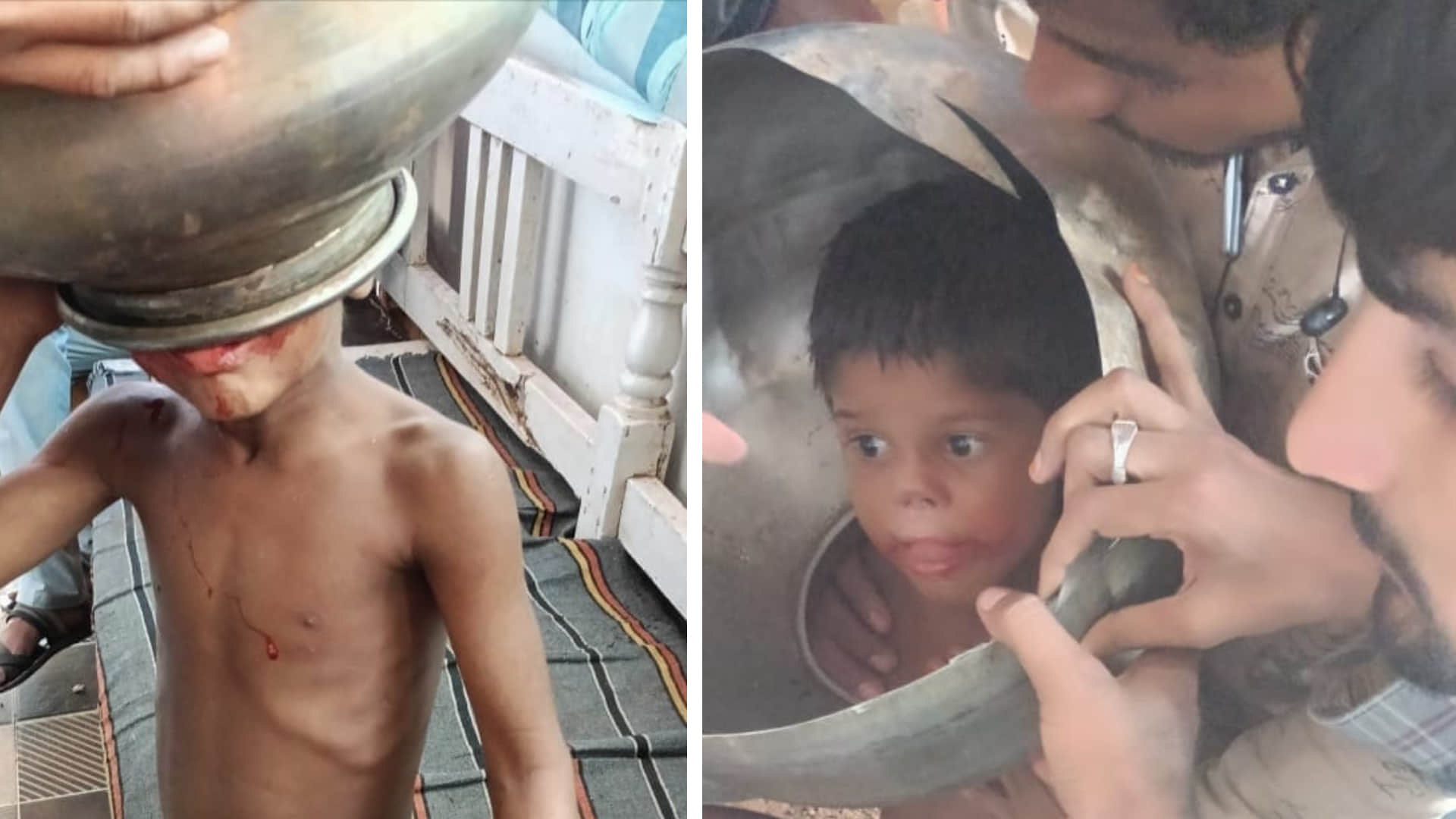 विदिशा में गगरी में फंसा बच्चे का सिर मशक्कत के बाद निकाला जा सका।