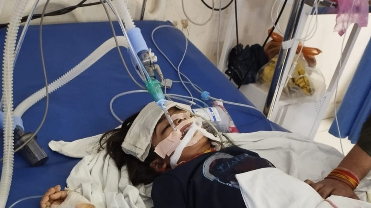 Bhopal: Six year old innocent girl sleeping in bed was bitten by a snake