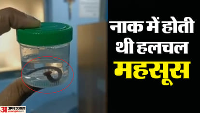UP: अद्भुत घटना..वाटरफॉल में नहाते वक्त नाक में घुसी जोंक, 15 दिन बाद जिंदा निकाली; लाल-काले रंग का आता था खून Leech entered nose while bathing in waterfall was taken out alive after 15 days IN Prayagraj
