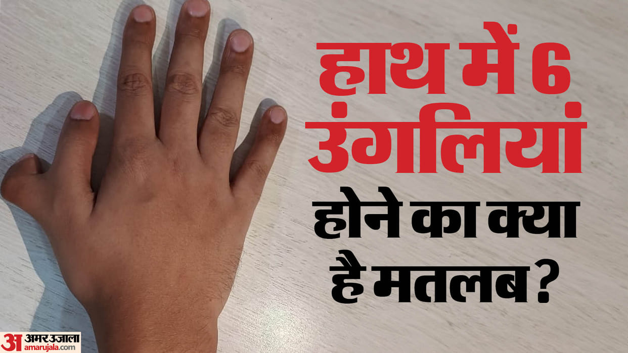 Hastrekha Vigyan haath mein 6 Ungaliyan hone ka Matlab Samudrik Shastra