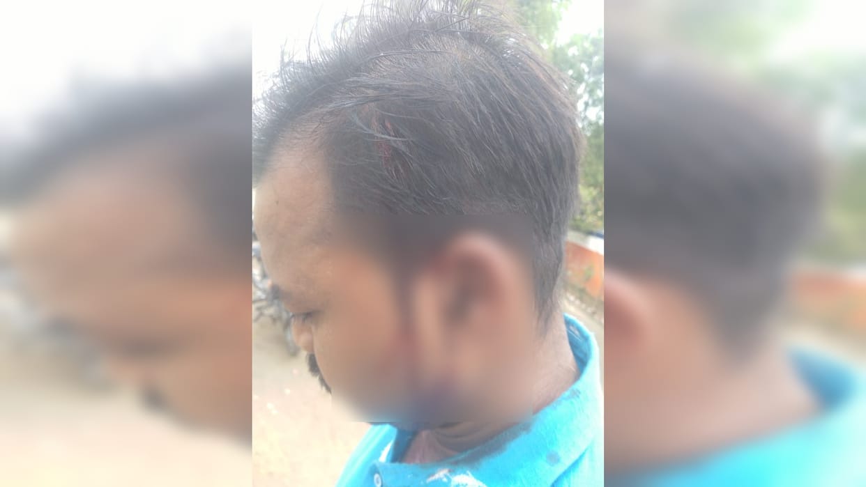 Washing machine blast after lightning, shopkeeper injured