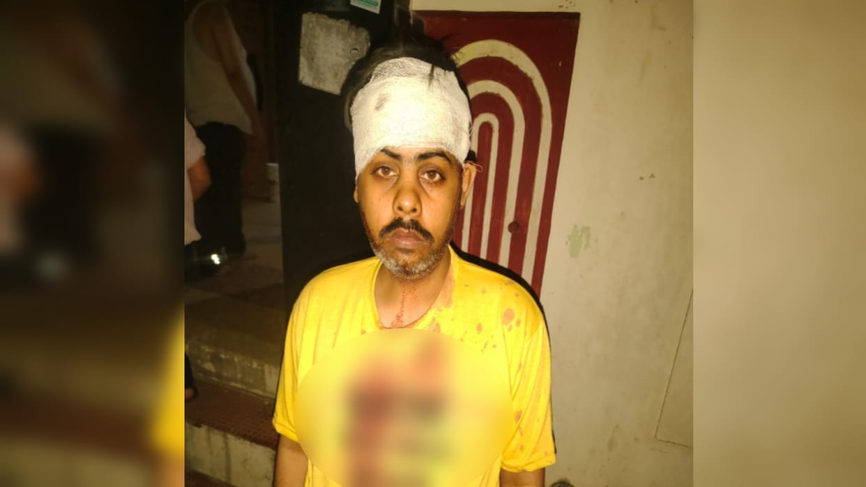 Shamli: Three people including businessman father and son attacked, one in critical condition