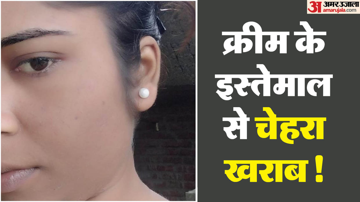 Skin diseases developed in process of making one fair