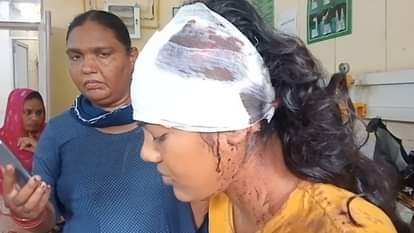 हादसे में घायल युवती अस्पताल में भर्ती।