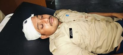 Unnao: गाली-गलौज कर रहे पिता-पुत्र ने किया पथराव, सिपाही को छत से फेंका…गंभीर हालत में रेफर, दोनों गिरफ्तार Abusive father and son pelted stones, threw a constable from the roof, referred in critical condition