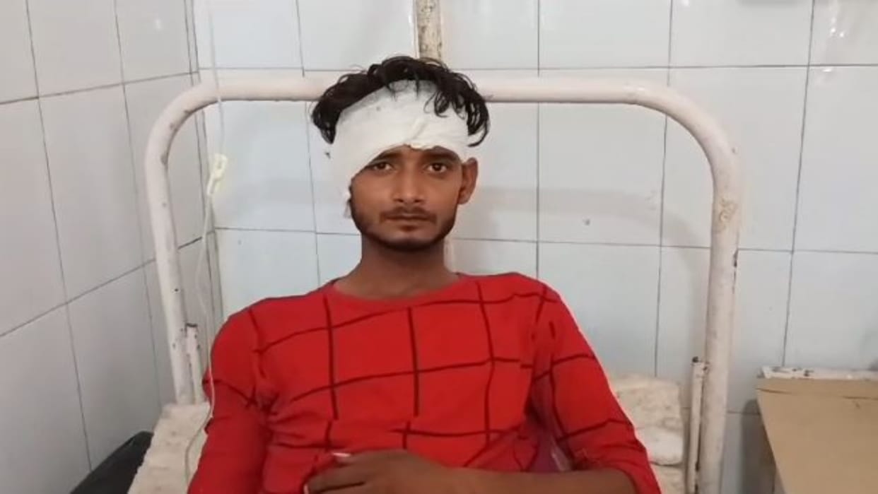 Alwar News: Bike rider injured in car collision, serious injury to head and leg, police registered case