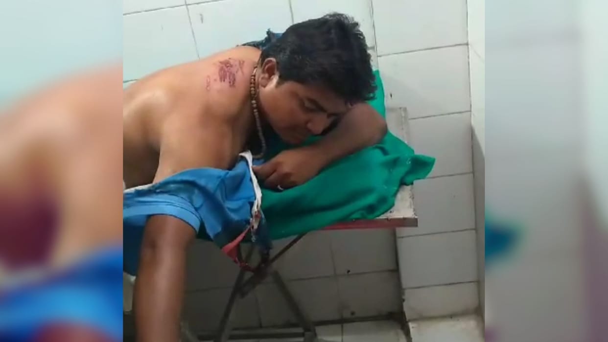 Sonbhadra News Elder father shot nephew case is related to enmity condition is critical
