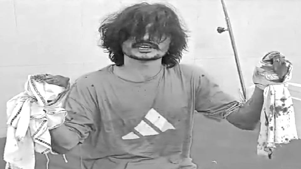 Fingers of both hands were cut off after abducting a young man in Palwal s Hodal