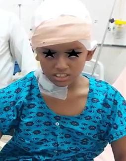 AIIMS News: A deadly brain tumor the size of a football came out of the girl's head, AIIMS doctors removed it