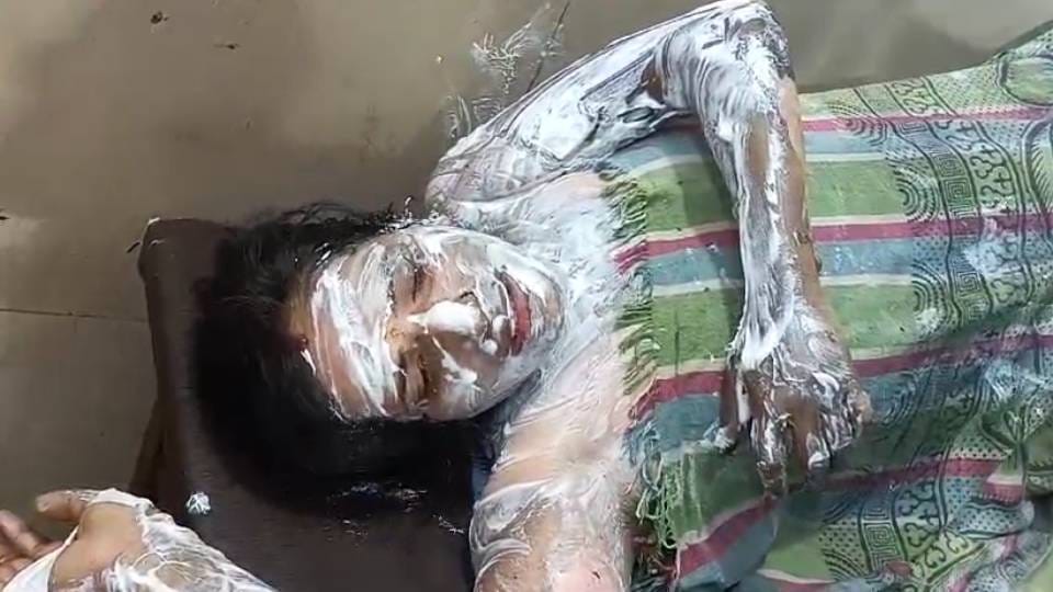 woman demanded money she had lent In Mainpuri accused tried to burn her alive by pouring petrol on her