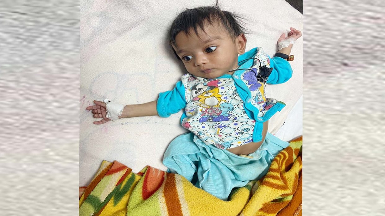 Kanpur: For the first time, hole in the heart of three-month-old child was closed
