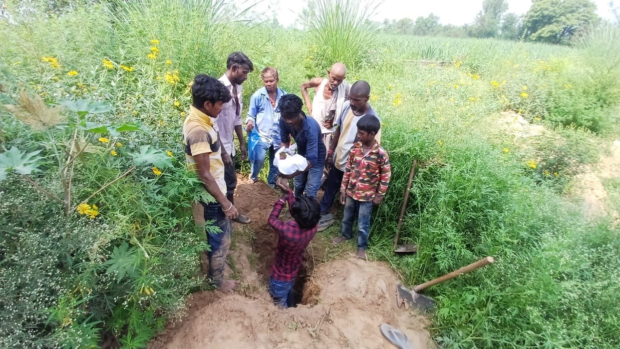 girls joined at chest lost battle of life, family had named them Laxmi