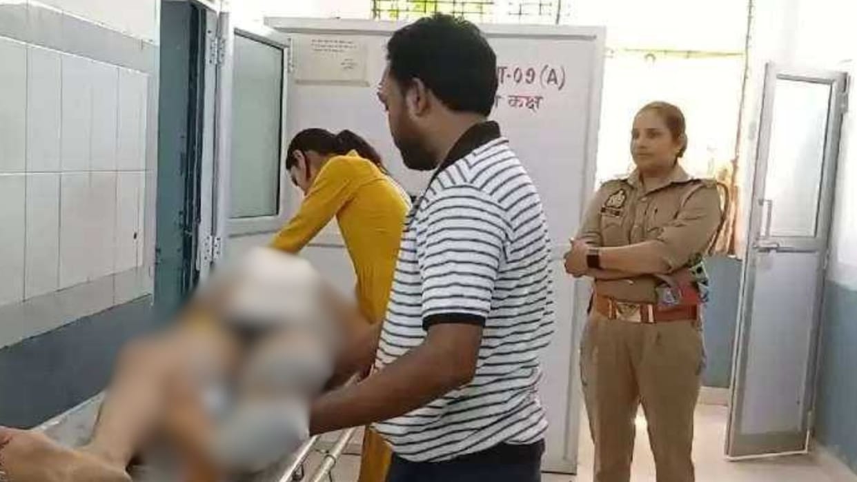 Attack on policemen in chandauli broke leg two injured investigation of the case
