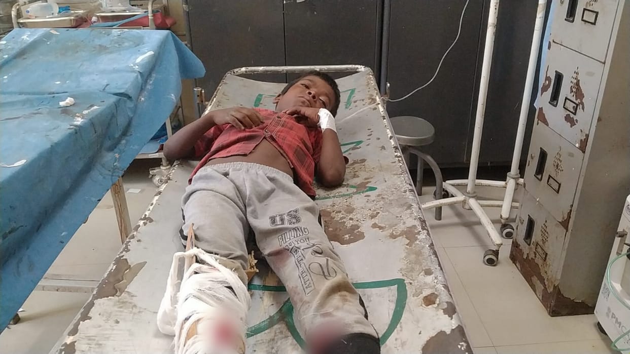 Bihar News: A child playing outside house in Nalanda was shot, referred to a higher center for treatment