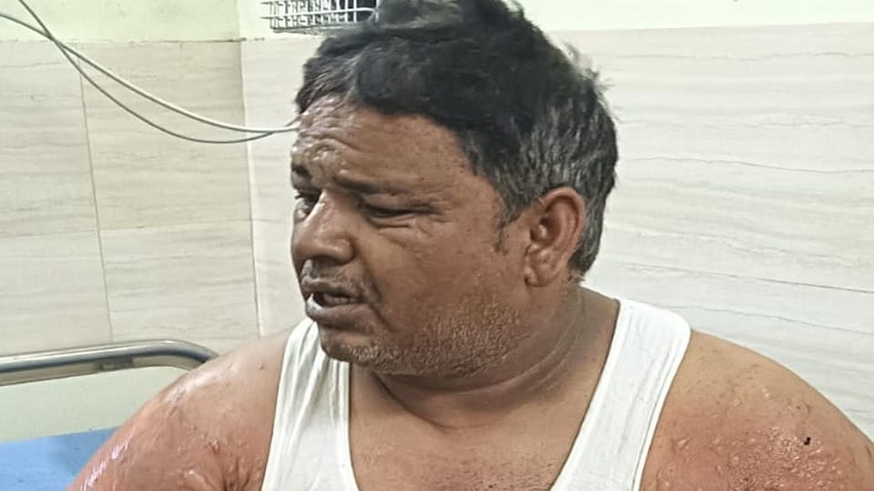 Woman dies in house fire due to gas leakage in jaspur udham singh nagar