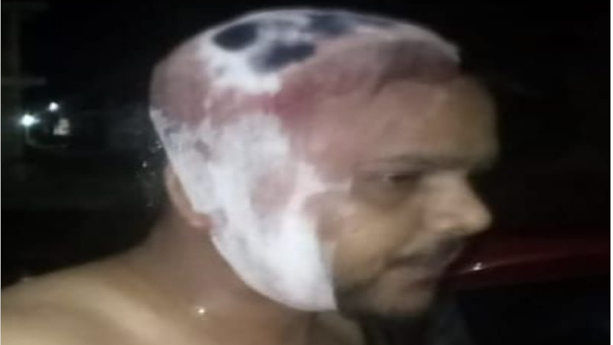 In Siddharth Nagar, consultant was attacked by putting chilli powder in his eyes, Rs 2.50 lakh was looted