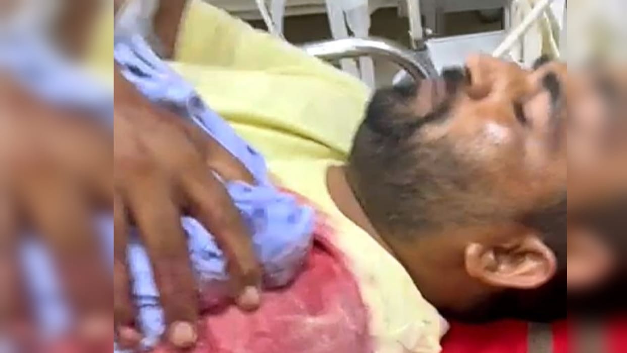 Miscreants riding a car shot a young man on the spot, serious. Miscreants riding a car shot a young man on the