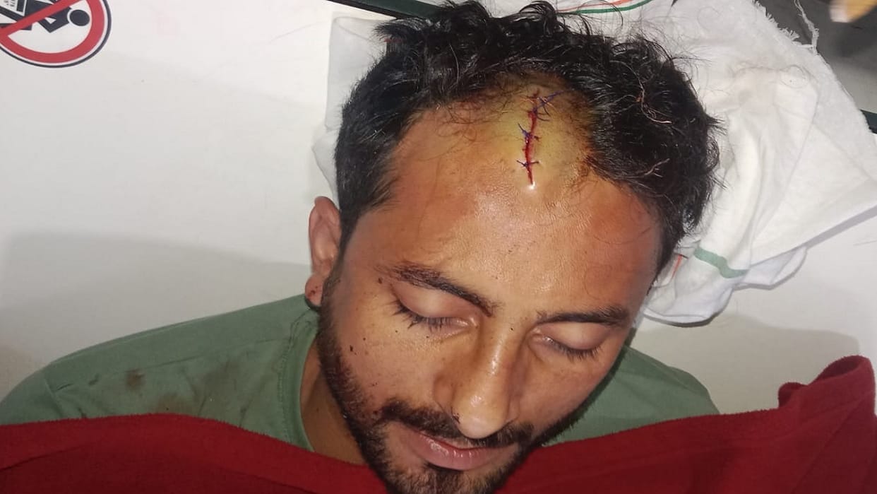 Beldars who went to stop canal water theft in Hansi were attacked
