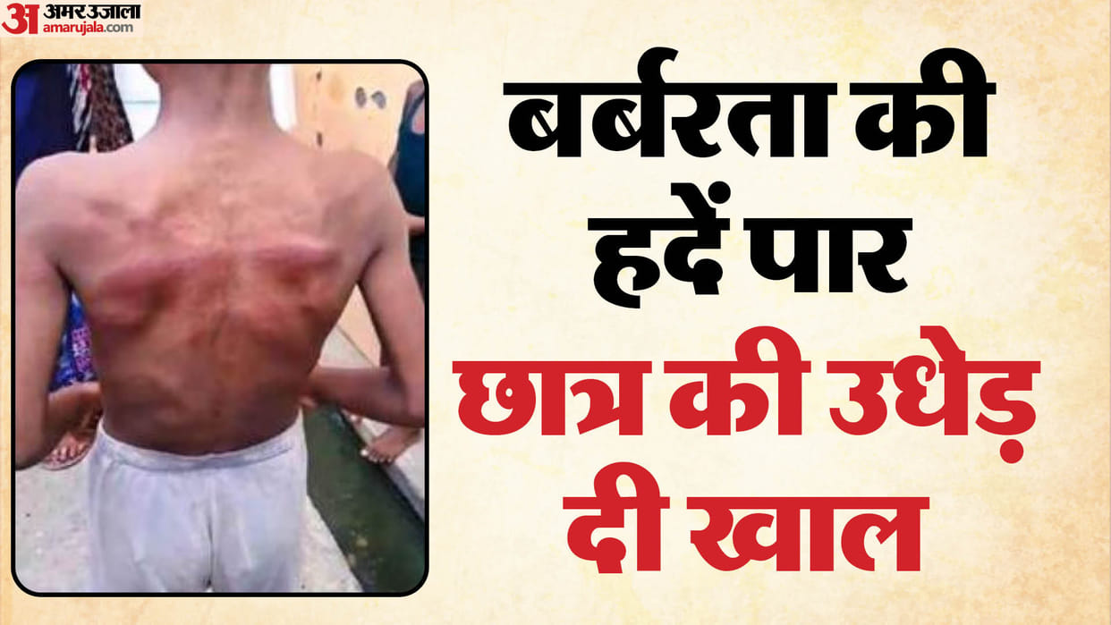 Teacher Brutally Beat Up a Scheduled Caste Student In Bareilly tore off his back skin