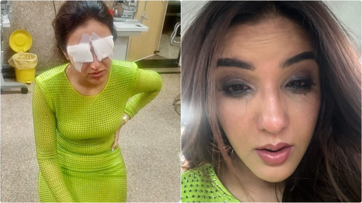 Jasmin Bhasin Health news Know Corneal Damage Symptoms Causes And Precaution Tips in Hindi