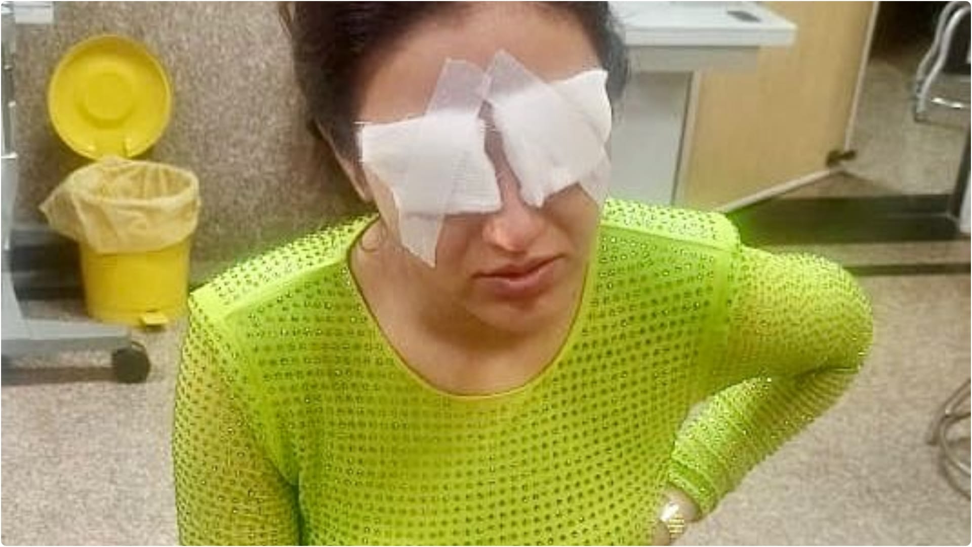 Jasmin Bhasin Health news Know Corneal Damage Symptoms Causes And Precaution Tips in Hindi