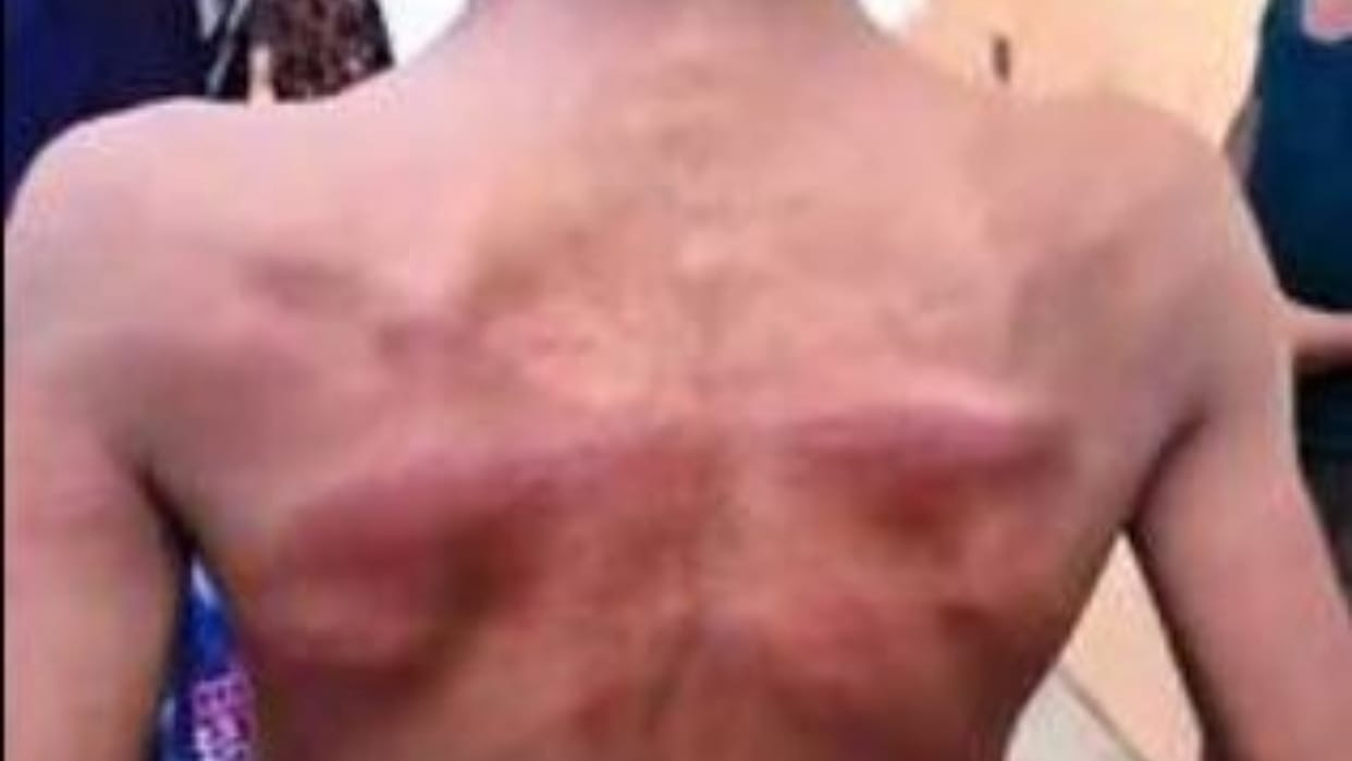 Teacher suspended for brutally beating student in Bareilly