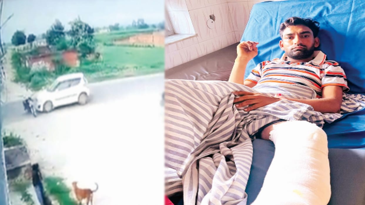 Meerut:  young man was hit by a police inspectors car, barely survived, doctors had to amputate his leg