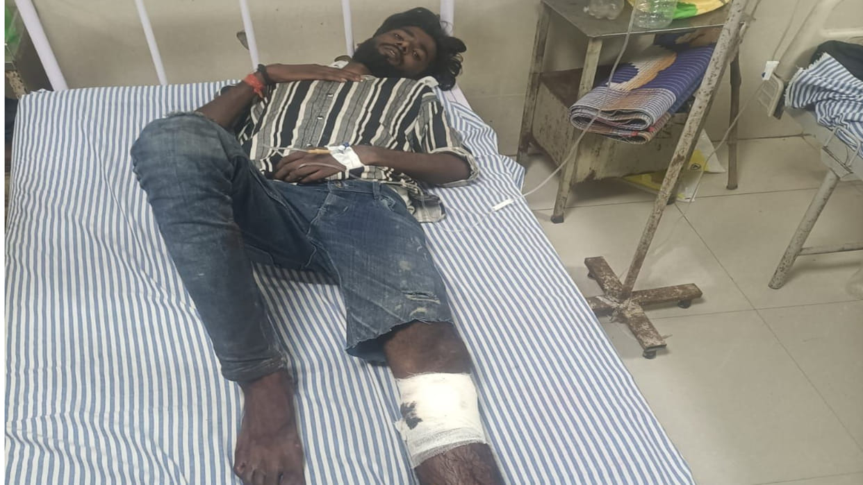 Criminal Nitish Yadav got injured in an encounter with police in Deoria district, admitted to hospital