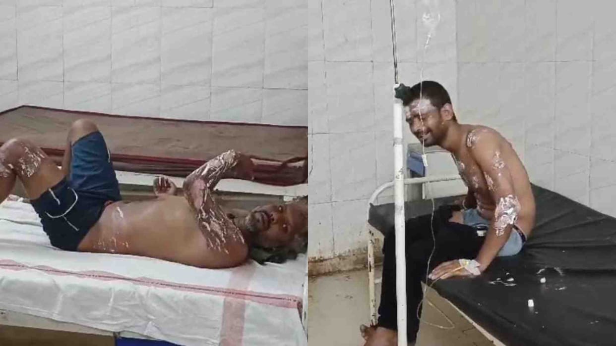 Sagar News: Stampede among passengers due to boiling tea falling in train