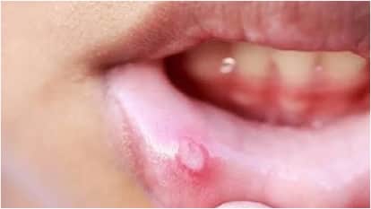 World Cancer Day 2026:  if you get any one of these signs then be careful