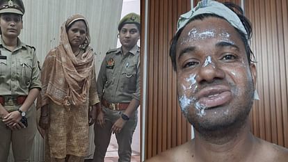 businessman burnt by his female friend by throwing acid on him In Khandari Agra