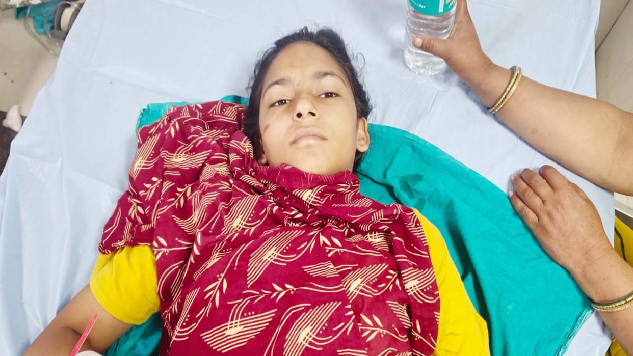 Etawah: Both legs of a girl student who fell from the train were cut off