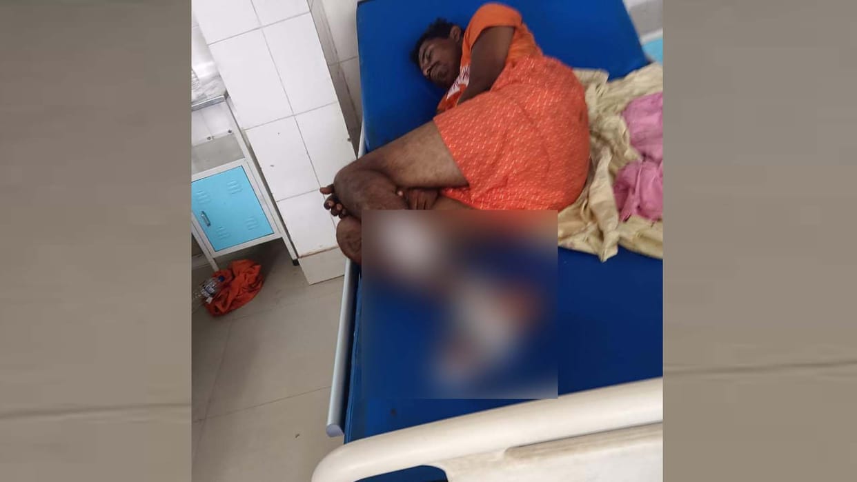Fatehpur: Kanwariya got hit by a train, leg cut off, admitted in hospital in critical condition