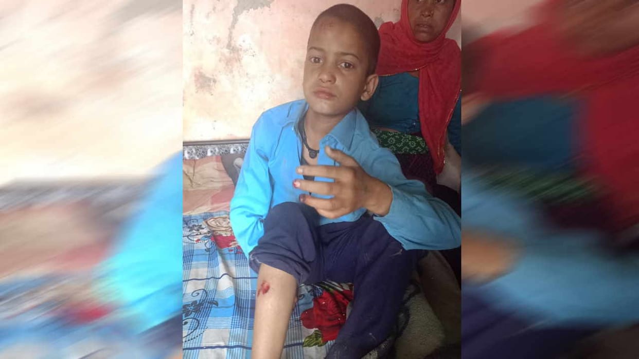 leopard attacked student GIC Budhna Jakholi block Rudraprayag News