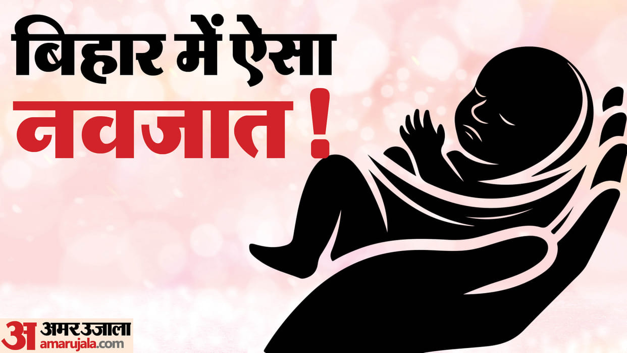Bihar News : abnormal face unique skin big eye child born in bagha Birth of a strange child birth rare case