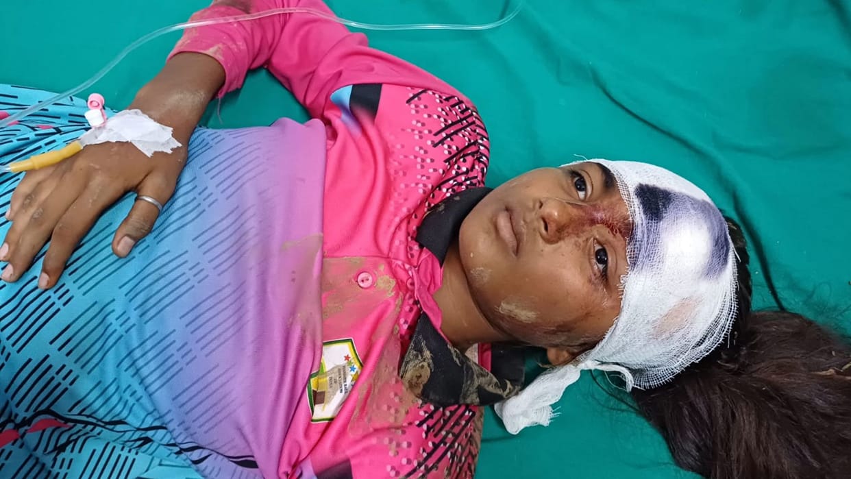 teacher learning to drive car crushed two students in sonbhadra one died other critical condition