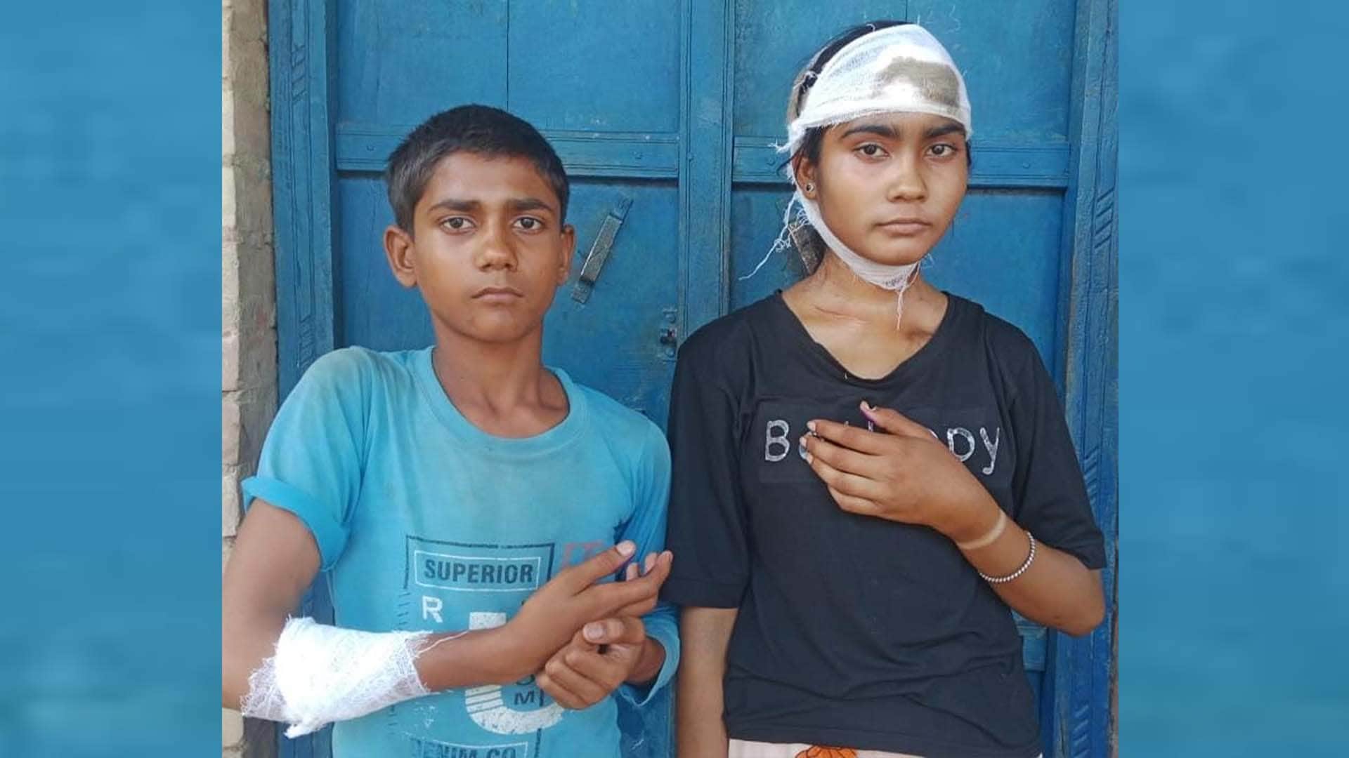 घायल बच्चे