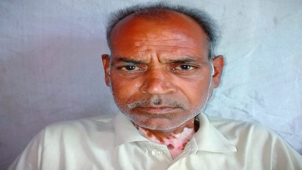 injured person died during treatment in the accident