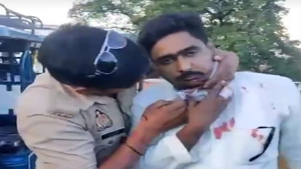 Rampur: Bike rider neck cut by Chinese manjha on Ram Rahim bridge, barely taken to hospital