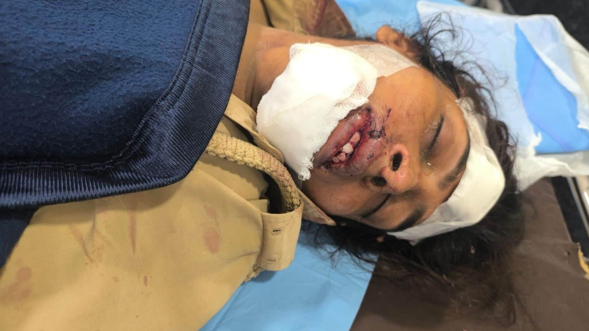 Big accident kashi vishwanath temple in varanasi see horrific scene in one click