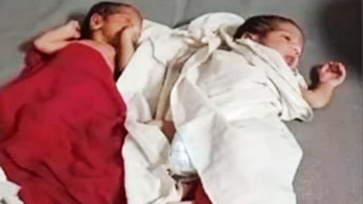 Gopalganj: Mother died after giving birth to twins, family members created ruckus, Negligence of doctors